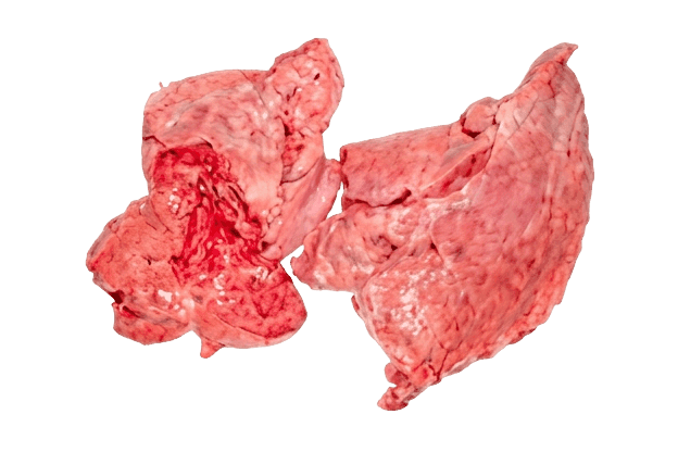 Lung