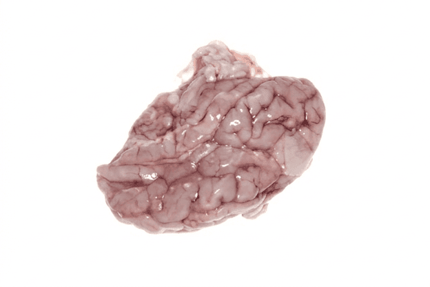 Brain