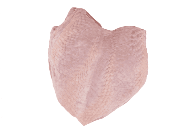 Breast